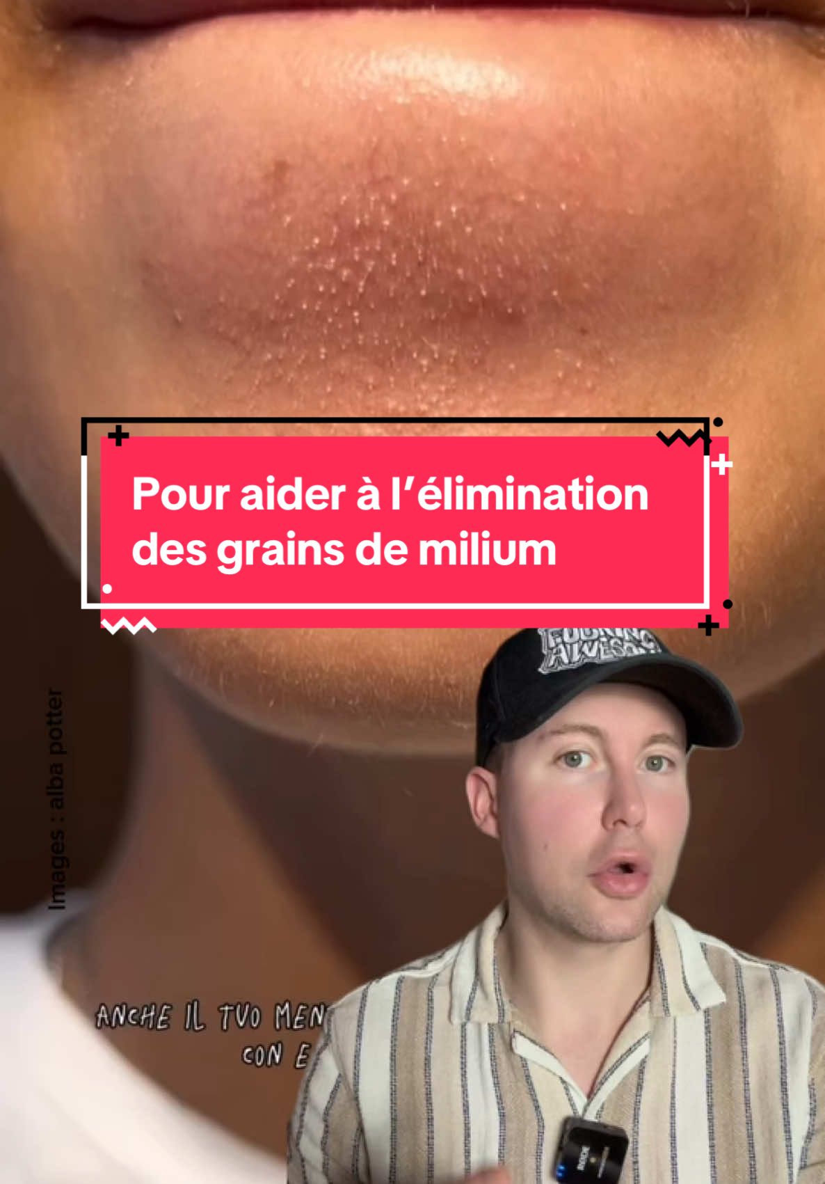 🛍️ Le LlEN de ce produit n° 354 est dans ma Bl0 (La Bl0graphie est le texte de présentation sur mon profil)😀/ P.UBLlClTE / Pour aider à l’élimination des grains de milium 