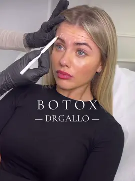 What about Botox? #botoxtreatment #botox #botoxfacial #antiage #tossinabotulinica #milano #drgallo #clinicamedicalgroup #dxb #dubai #newclinic #medicinaestetica #aesthetics #perte 