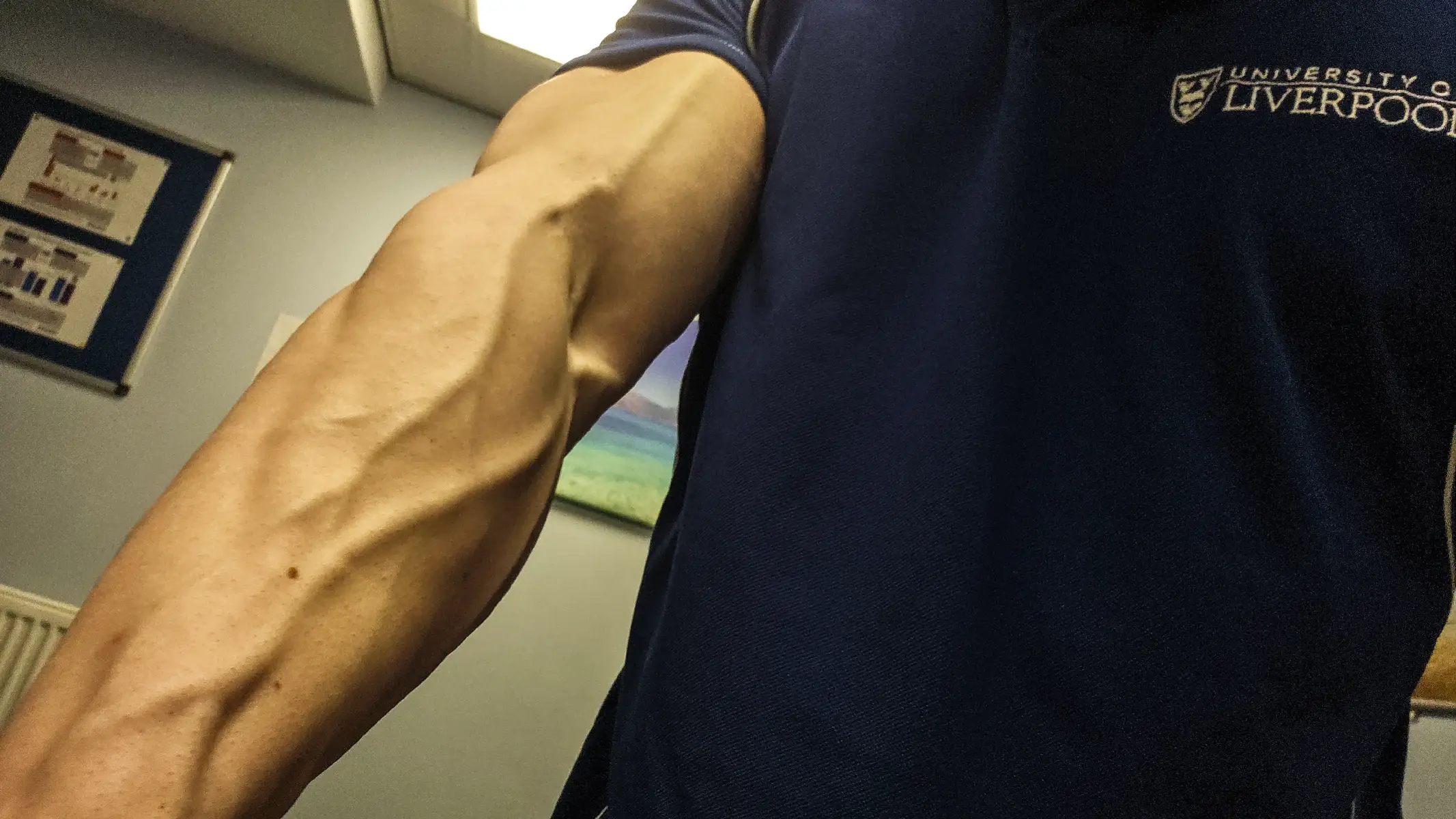 #forearms 