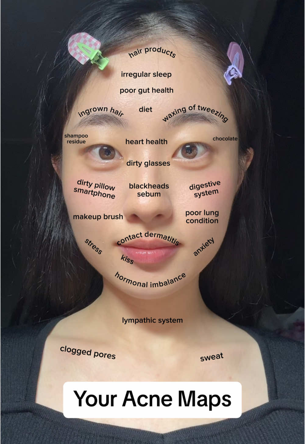 find ur skin probs🧐 #acnemap #acne #acnefighter #acneskin #acneproneskin #acnetreatment #contactdermatitis #blackhead #sebum #glassskin #skincare #skintok #koreanskincare #kbeauty #fyp #foryourepage cr:@CHxRyGLOW🫧 | Kbeauty 