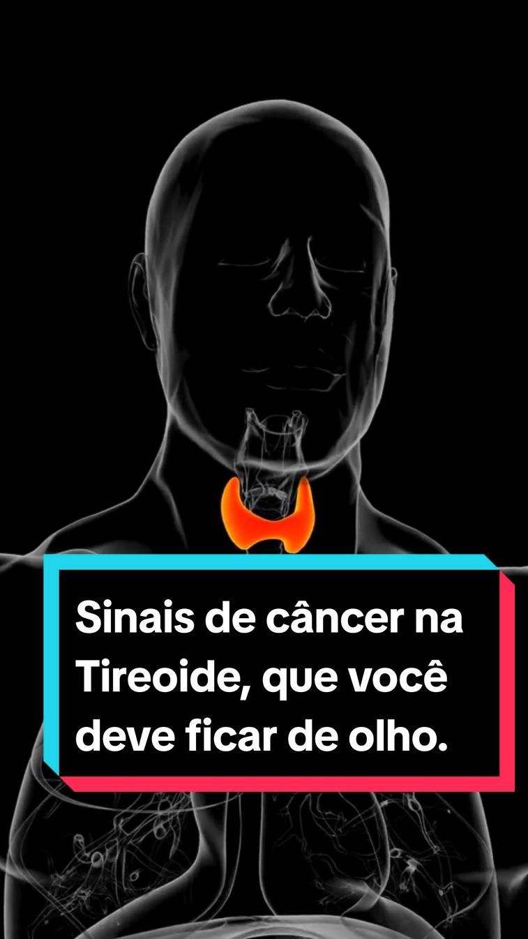 Sinais de câncer na Tireoide, que você deve ficar de olho. #tireoide #cancer 