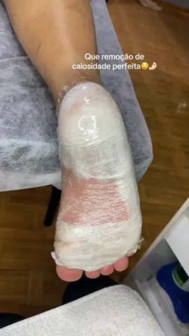 #fyyyyyyyyyyyyyyyy #foryoupage❤️❤️ #spadospés #videosatisfatorio #trabalhomanual #plasticadospes #fypdong #atendimentopersonalizado #pedicure #pedicuretools #videosaleatorios 