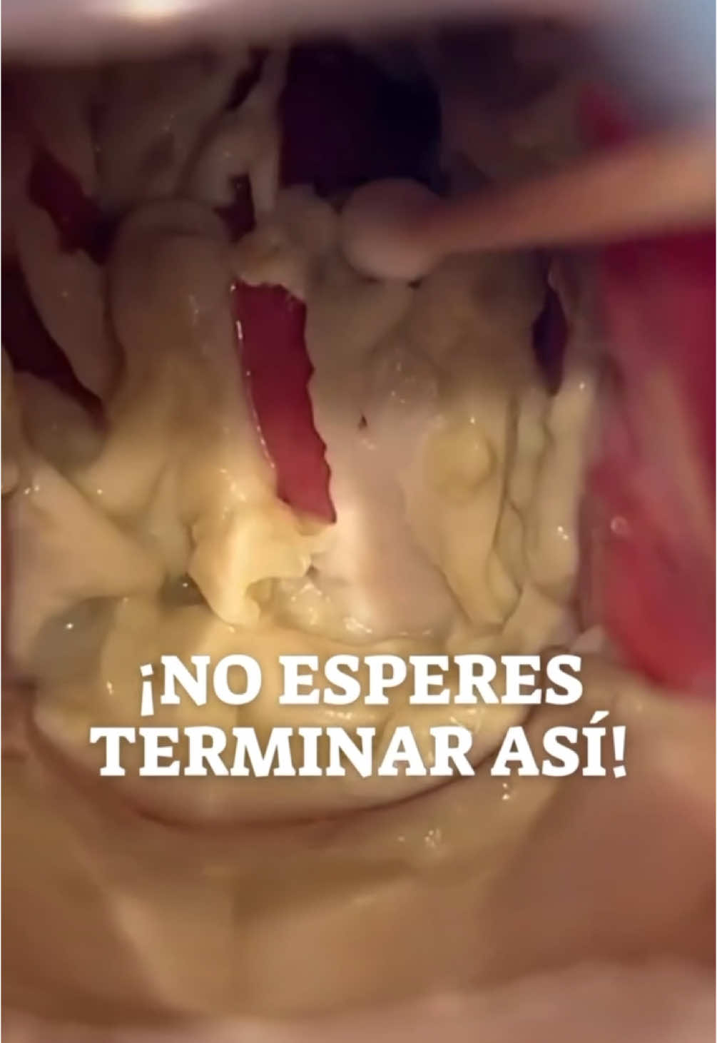 #candida #candidaalbicans #viral_video #ginecologo #infeccionesurinarias #ginecologo #peru 