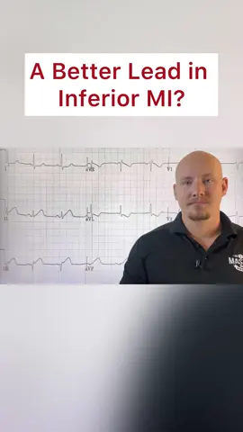A better lead in inferior MI? 🫀 #paramedicschool #paramedicstudent #paramedictraining #paramedic #paramediceducation #paramedicstudents #ems 