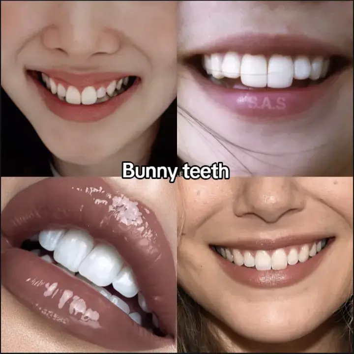 #teeth #straightteeth #vampireteeth #bunnyteeth #gapteeth #canineteeth #crooked #tooth #smile #teethcare #beauty #foryou #foryoupage #xybca #fyp