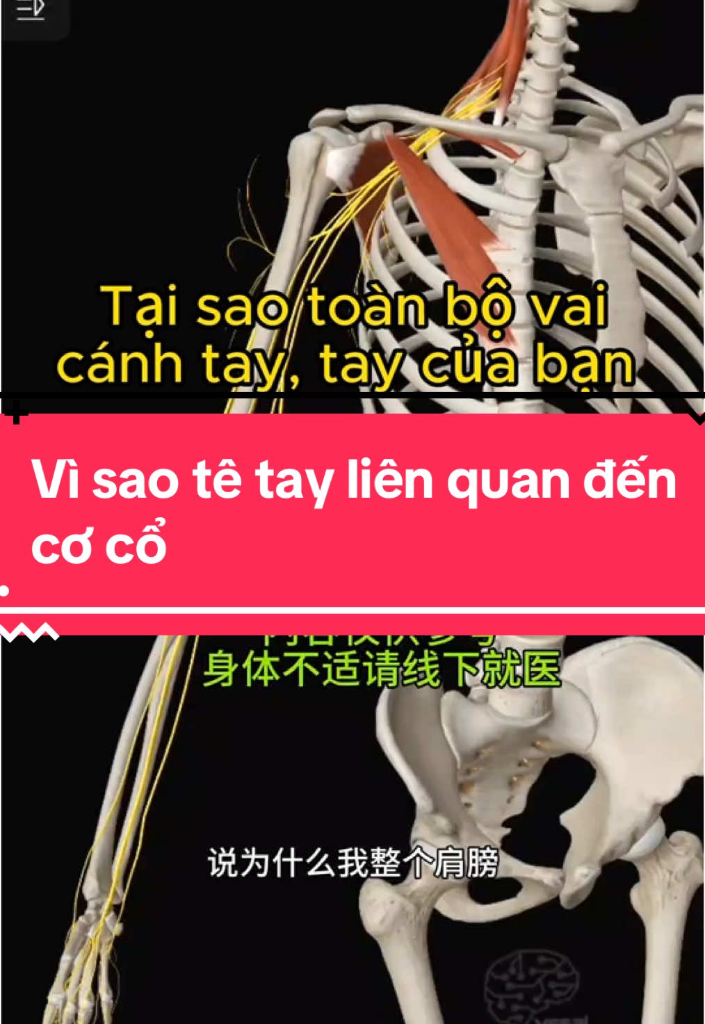 Vì sao tê tay liên quan đến cổ ? Cùng xem giải phẫu nhé ! #xoabopbamhuyet #yhoccotruyen #yhcttrunghoa #căngco 