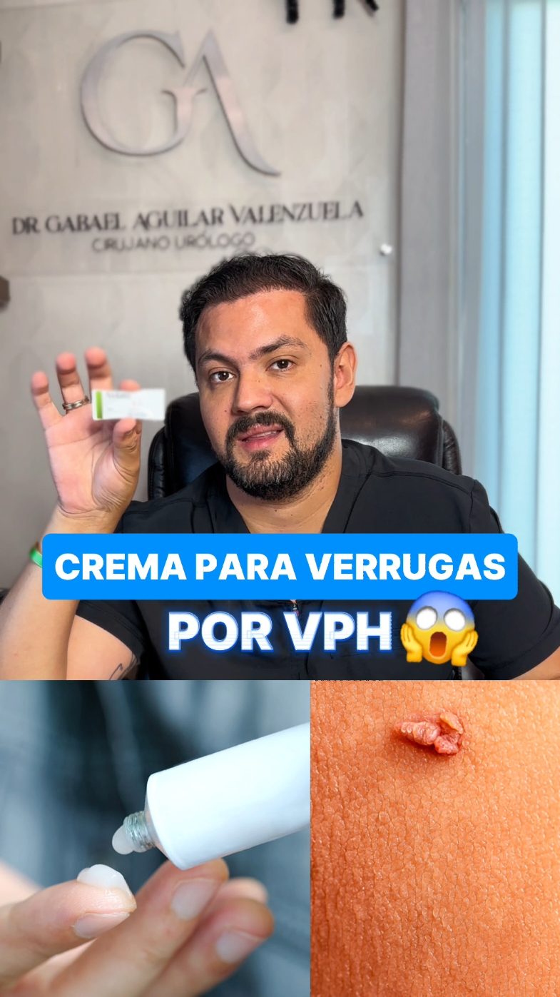 CON ESTA CREMA PUEDES QUITARTE LAS VERRUGAS POR VPH😱 Pero ojo... Es importante que un profesional identifique que tus verrugas sean por esta razón, y tiene su debido tiempo en dar resultados. Lo mejor siempre va a ser empezar el esquema de vacunación y manejar el retiro con profesionales de la salud. ¿Te encuentras en Culiacán y quieres retirar tus verrugas por VPH? Agenda tu cita Urólogo en Culiacán, Sinaloa, México Agenda tu consulta al +52 667 207 8017 ó para cita presencial en Culiacán, Sinaloa directamente en mi página de Doctoralia https://www.doctoralia.com.mx/alberto-gabael-aguilar-valenzuela/urologo/culiacan 🩺 Circuncisión, cirugía estética genital, cirugía de próstata, VPH, enfermedades de las vías urinarías y más. COFEPRIS 2425042002A00040  #urologia #urologo #culiacan #vph #papilomahumano #virusdelpapilomahumano #ets #verrugas 