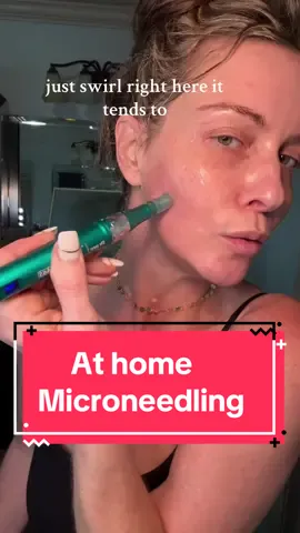 My 15 minute at home microneedling session #creatorsearchinsights #favoritethings #nofilter #fyp #over40club #over40mom #over40skincare #skincareroutine #glowingskin #real #reallife #sahm #teamwork #womensupportingwomen #followforfollow #foryoupage #microneedlingface #microneedlingtherapy #drpenmicroneedling #drpen  @Dr. Pen Global 
