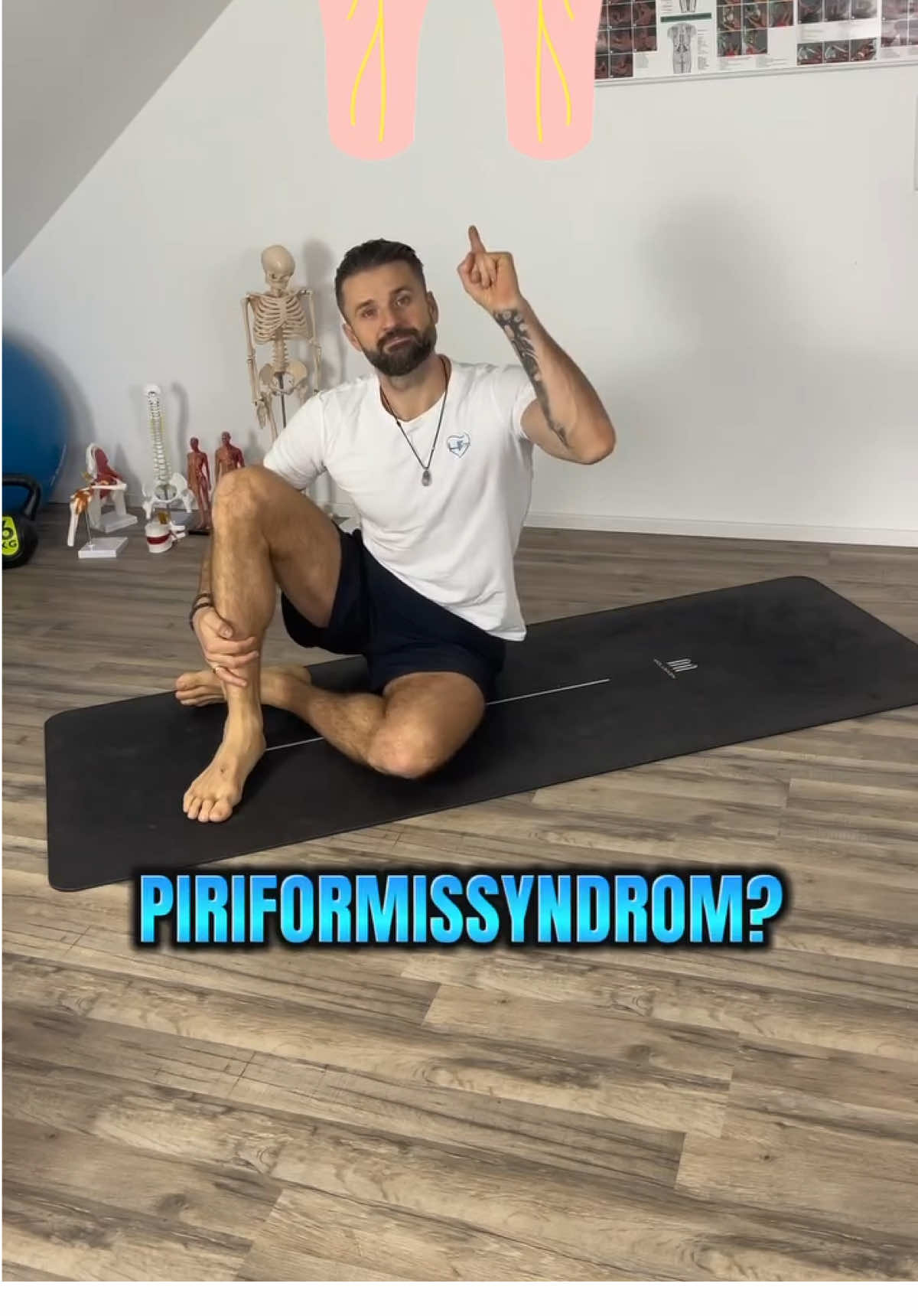 Piriformissyndrom? #dkhealth #ischias #piriformissyndrome #piriformis #ischiasschmerz #gesund #fit 