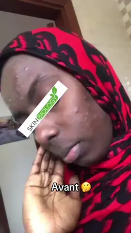 Il ne s’agit plus d’hesiter mais de passer à l’action, RIGHT ??? #skinbiology #skinbiology🇸🇳 #skincare #skinbiologysenegal #funny #tiktoksenegal🇸🇳 #dermocosmetique #fyp #skincareroutine #duoretinol #acne #tiktoksenegal 
