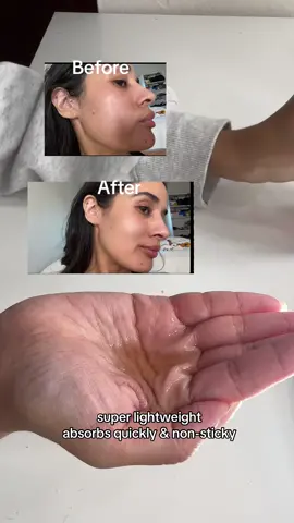 @acwell_official #fy  #acwell #licorice #toner #acneprone #acneproneskin #acne #acnetreatment #phbalancing #koreanskincare #beauty