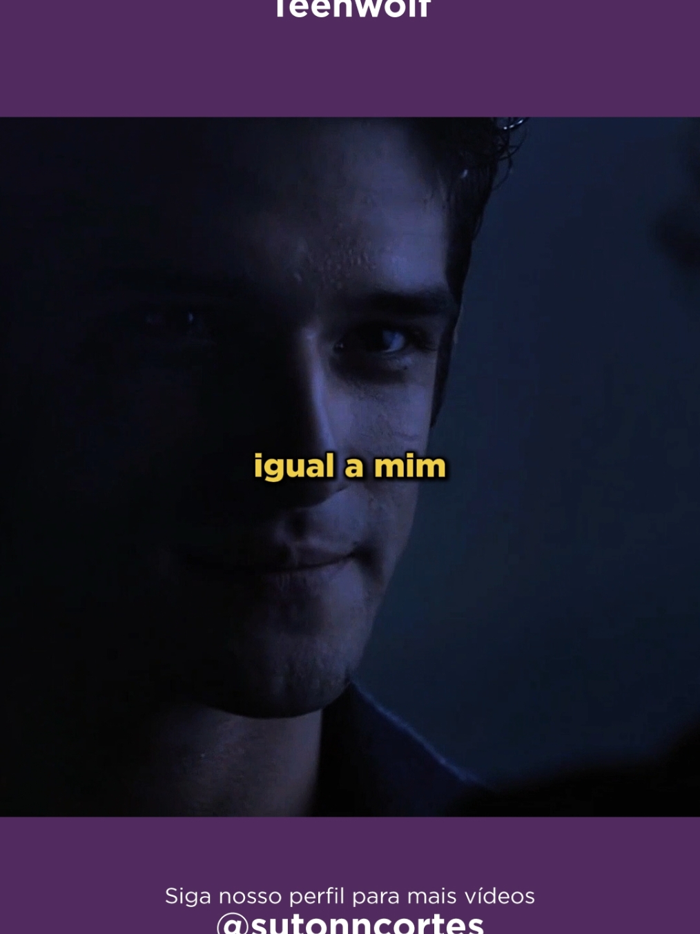 Teen Wolf 📖 Sinopse: Scott McCall, um adolescente de Beacon Hills, tem sua vida transformada ao ser mordido por um lobisomem. Enquanto enfrenta desafios de sua nova identidade sobrenatural, ele conta com o apoio de amigos como Stiles, Lydia e Derek. Juntos, eles enfrentam inimigos perigosos, resolvem mistérios e tentam proteger a cidade. 📺 Onde assistir: Disponível na Paramount+. 👉 Marque aquele amigo(a) que adoraria se aventurar nesse universo cheio de mistérios e ação sobrenatural! . . . . . #dicasdeseries#cenasdeseries#teenwolf