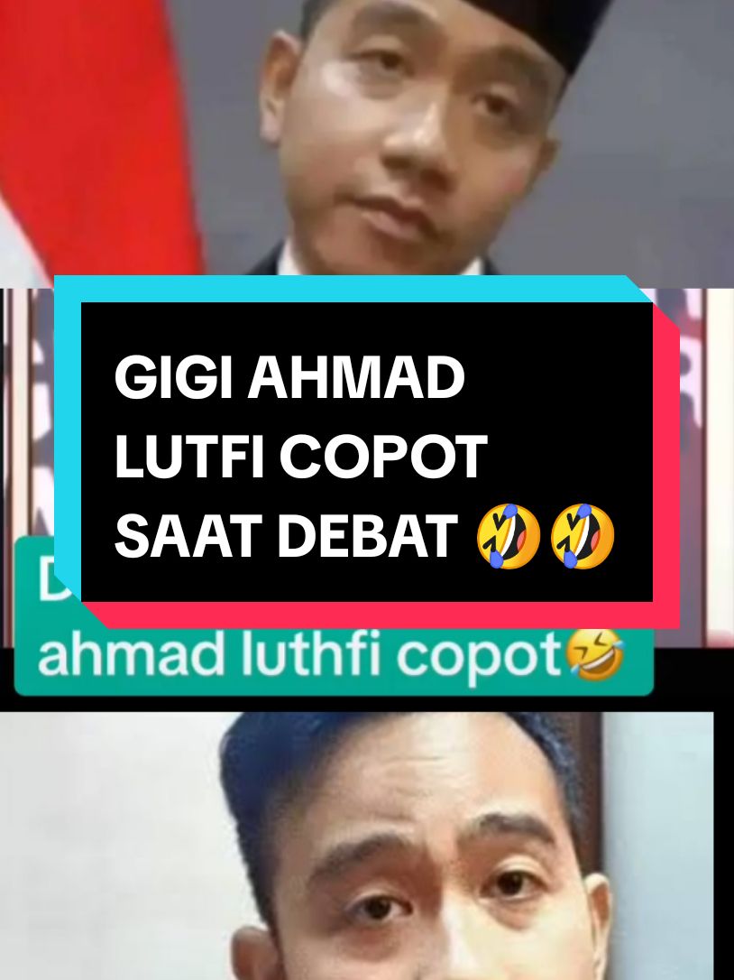 GIGI KO ISO COPOT 🤣🤣#SOROTAN #semuaorang #TRENDING 