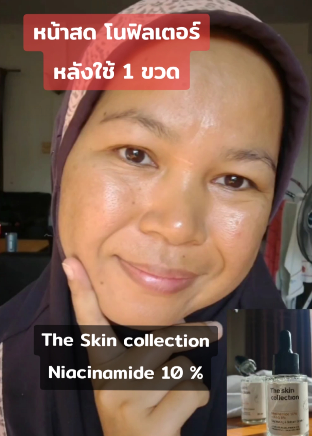 The skin collection Niacinamide หลังใช้หมด 1 ขวด #theskincollection #niacinamide #เซรั่มtheskincollection #รีวิวบิวตี้ #ป้ายยาสกินแคร์ #ป้ายยาtiktok 