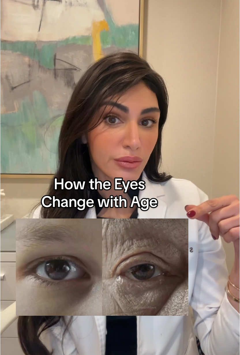 How the eyes change with time #undereyecircles #antiaging #wellness #beauty #medical #LearnOnTikTok #BeautyTok 