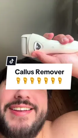 It’s on a DUMB sale right now bruvs #tiktokfinds #callusremoval #callusremover #callus #feetcare #feet #tiktokshopblackfriday #tiktokshopcybermonday #tiktokshopholidayhaul #GiftGuide #TTSDelight 