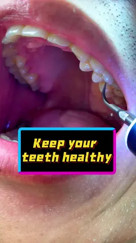 Say goodbye to bad breath#oralcavity #tiktokshopsummersale #dealsforyoudays #HULMAY#tiktokshop #foryou #tiktok#oralhygiene #dentalstain #ultrasonic 