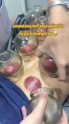 สีของรอยครอบแก้วที่เข้ม ไม่ได้ขึ้นอยู่กับเพศ แต่ขึ้นอยู่กับอาการปวด รวมถึงความร้อน ความชื้นที่สะสมในร่างกายด้วยค่ะ ผู้หญิงก็มีรอยครอบแก้วเข้มๆไม่แพ้ผู้ชายเลยค่ะ #ครอบแก้ว #ปวดหลัง #ออฟฟิศซินโดรม #ครอบแก้วรักษาอาการปวด #ครอบแก้วแก้ปวด #แพทย์แผนจีน #ปวดหัวไมเกรน #ฝังเข็มอ่อนนุช #dryneedling #cupping #ฟาจินคลินิก 