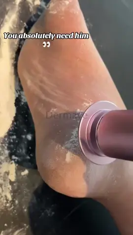 Pamper Your Feet — They Deserve It! Make foot care easy and effective! 🧗🏻✨ The Dermave Electric Foot Callus Remover buffs away tough spots and keeps your feet looking smooth and healthy. 💖 Get ready to feel the comfort of baby-soft feet today! 💜🌟 #Dermave #HealthyFeet #homepedicure 