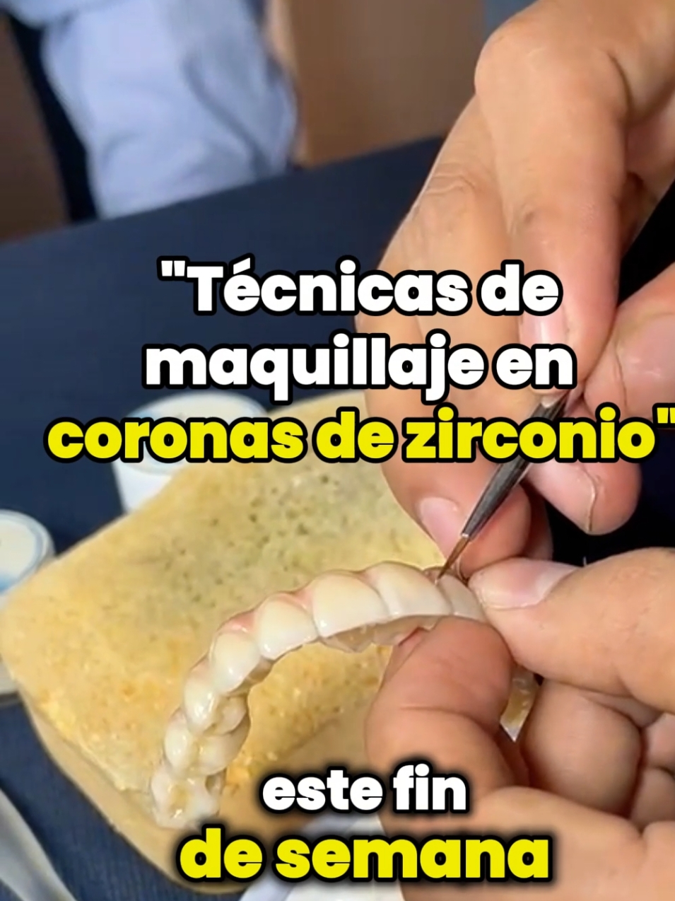 En nuestro Laboratorio de Zirconio CAD/CAM, seguimos perfeccionando nuestras técnicas para ofrecerte coronas de zirconio de la más alta calidad. Recientemente asistimos a un curso especializado en maquillaje de zirconio, donde aprendimos nuevas técnicas de pintado y personalización antes del proceso de horneado. ¡Innovación y excelencia para sonrisas perfectas! #odontólogo #odontología #dentista #zirconio #zirconiodental #ZirconioCADCAM 