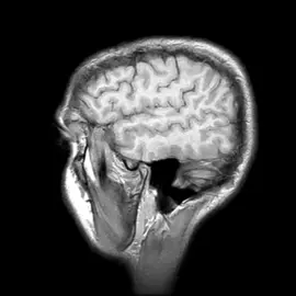 3D human identity #human #himanity #humanbody #biology #edit #soul #3d #humans #viralll #fyp #blowup #fup 