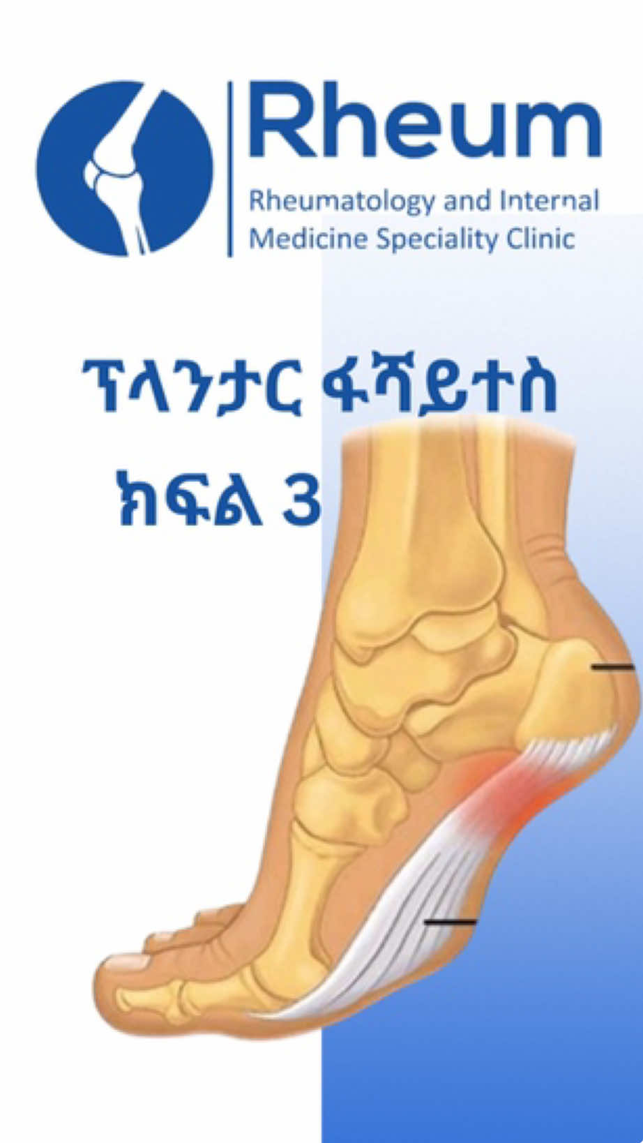 Plantar fasciitis 1️⃣0️⃣3️⃣ ሩሁም የሩማቶሎጂ እና የውስጥ ደዌ ስፔሻሊቲ ክሊኒክ!  #plantarfasciitis #rheum #plantar #heels 