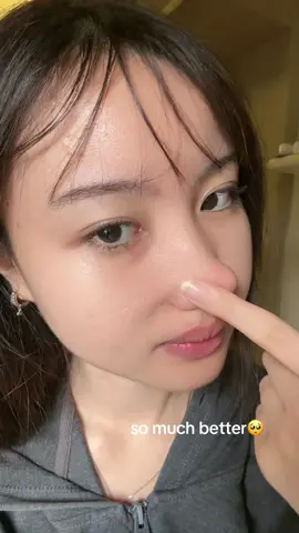 ini tuhh kusam abis begadang di solo yang tidurnya cuma 2 jam perhari😔 #PeelingSolution #g2gpeelingsolution 