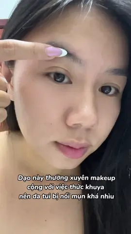 Vị cứu tinh của tui mỗi lần bị mụn 🫶🏻 #byebyeblemish #chammun 
