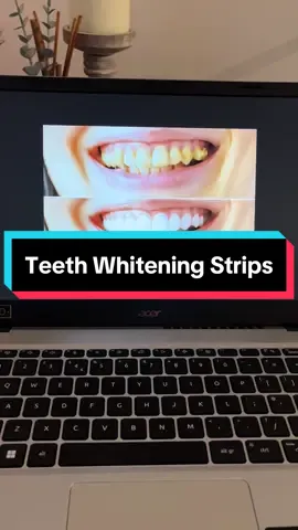 The perfect way to get whiter teeth from your home 🦷 #TeethWhitening #GiftIdeas #TikTokMadeMeBuyIt #BlackFridaySale 