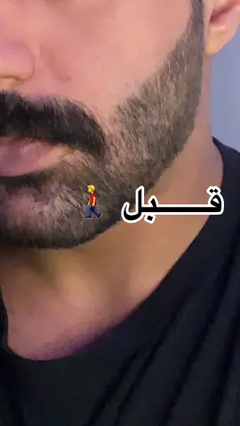 قلم لحية وشنب لسد الفراغات 🖊️ #CapCut #fypシ #قلم #kuwait #الشعب_الصيني_ماله_حل😂😂 #قلم_لحية #الكويت🇰🇼 #هاشتاق 