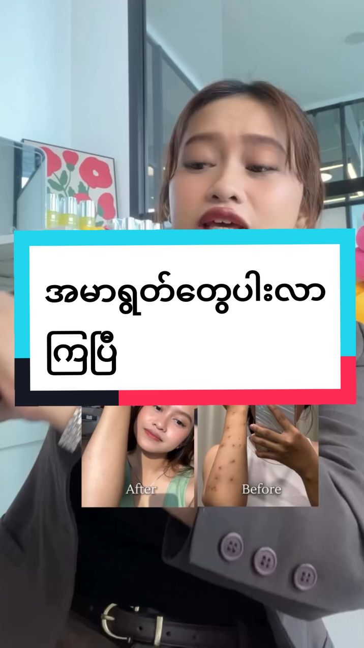 ထိုင်းမှာလည်းပြောကုန်ကြပြီ#အသားမဲဘဝကိုစွန့်လွတ်လိုက်ပါ #ဆေးထိုးဆေးသောက်စရာမလိုဘဲဖြူကြမယ်🙆🏻🙆🏻 #အမာရွတ်ပျောက်ချင်သူများအတွက် #gluta #review #glutapinksoap #2024tiktok #foryoupag #tiktokmarketplace #Mazin 