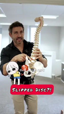 Slipped disc and back pain. ##backpain##backpainrelief##slippeddisc