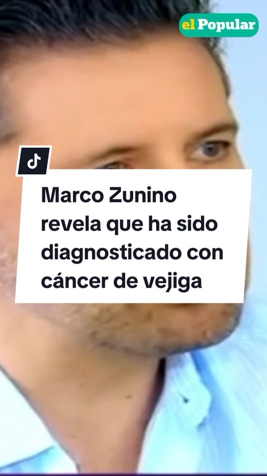 Marco Zunino reveló que se encontraba realizando los ensayos generales de 