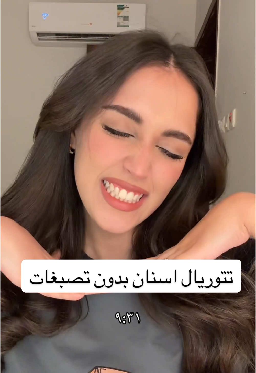 تحصلوهم ف اي صيدليه او مراكز العنايه🫶🏻 #4u #viral #foryou #fypage #foryoupag #Ad 