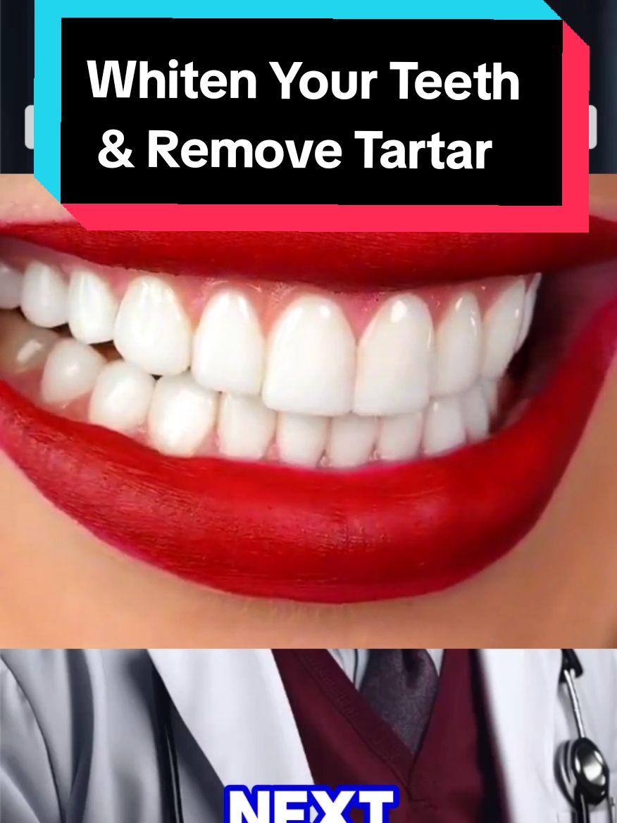 Whiten your teeth and remove tartar at home with this natural recipe. #teeth #whitening #Recipe #teethwhitening #teethwhiteninghack #whiteningteeth #teethcare #yellowteeth #naturalremedies #naturalremedy 