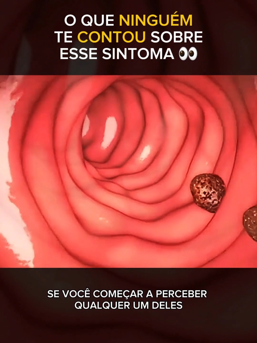 Alerta! Isso pode estar acontecendo com você agora e você nem percebeu! Não deixe para depois!  #educação #Saúde #atençao 