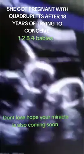 #Ivf #fyp #ttc #infertility #fibroids #infertilitysucks #fyp #luijorney #lui #ivfjourney #endometriosis #pcos #foryoupage#tryingtoco ceive #tiktok #divorce #uk #ukliving #usa #usa #newyork #germany #sweden #france #francescototti #canadawale 