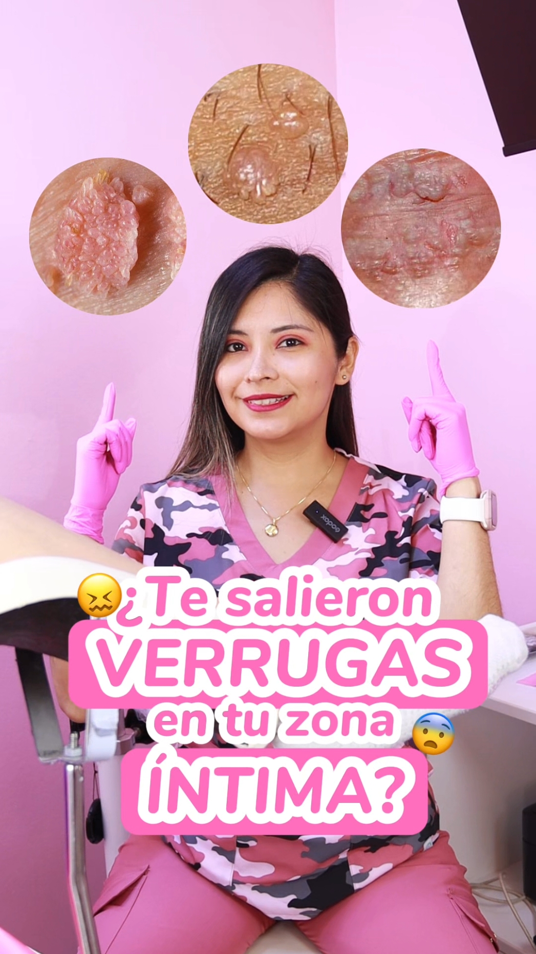 Te salió un bultito ahí abajo y no sabes que es? 🫣 Pueden ser verrugas 🚨 Síguenos que podemos ayudarte a eliminarlas 🤩 #vph #verrugas #verrugasgenitales #its #cauterizacion #cauterizaciondeverrugas #tratamientoverrugas #tratamientovph #eliminaverrugas 