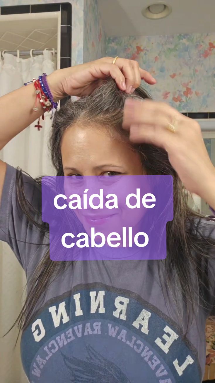 Estas experimentado caída de cabello?👩 💭Te entiendo perfectamente, quiero que sepas que no estas sola y suele pasar por diferentes factores como por ejemplo, cambios hormonales, medicamentos, estrés, enfermedades y cuando no sabemos cuidar de nuestro cuero cabelludo💆‍♀️ 💭Yo también he tenido perdida de cabello, y con el uso de este suero te puedo decir que he visto crecimiento, especialmente en mis entradas. Pero eso sí hay que ser constante y confiar en el proceso, ya que cada caso es distinto pero hay que ser constante si quieres ver resultados.  📲Envíame un DM o comenta la palabra  💬*Crecimiento* para ayudarte a tenér el tuyo y que tu también tengas tu propio testimonio🫶 #productosnaturales #programavip #productosdebelleza #mujeremprendedora #negocioonline #cabello #haircareproducts #crecimientodelcabello #calviciefeminina  #productosparaelcabello #sueroparaelcabello #crecimientodelcabello #calviciefeminina #mujeremprendedora #suerocrecimiento