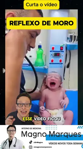 Reflexo de Moro 😱👶 #medicina #medico #curiosidades #enfermagem #enfermeira #pediatriaonline #bebe #foryou #foryoupage #fyp #viral_video #viralvideos #viral #viralditiktok #viraliza #viralvideotiktok #Saúde #Medicina #Enfermagem #ProfissionaisDaSaúde #CuidadosComASaúde #VidaSaudável #BemEstar #Médico #MedicinaÉVida #Doutor #Clínica #Consultório #Especialista #SaúdeÉPrioridade #Enfermeira #EnfermagemComAmor #CuidadoDeEnfermagem #EnfermeirosNaLinhaDeFrente #TécnicoDeEnfermagem #EnfermagemÉArte #AnjosDeBranco #SaúdeEPrevenção #ConhecimentoÉSaúde #CuideDeVocê #EducaçãoEmSaúde #SalvandoVidas #HéroisDaSaúde