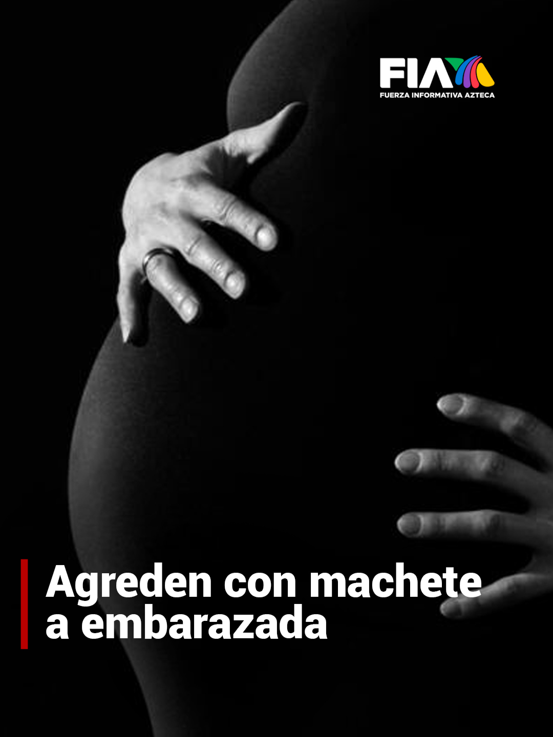 ¡Qué impotencia!  Una mujer embarazada de 35 años fue atacada con un machete en San Pedro Tlaquepaque, Jalisco, durante un intento de asalto.  La agresión ocurrió cuando un hombre intentó robarle su mochila. Al resistirse, la mujer fue herida en la cabeza. A pesar de las lesiones, su estado de salud se reporta con lesiones leves. Los detalles en #HechosAM  #AztecaNoticias #Noticias #News #FIA #Inseguridad #Asalto #Jalisco #México #LoDescubríEnTikTok #TikTokInforma