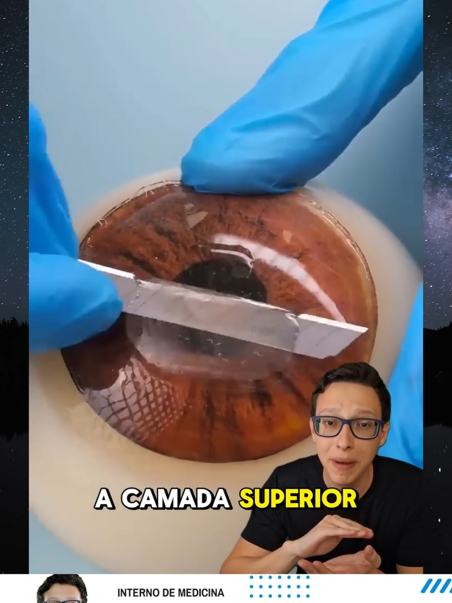 Corrigindo Miopia 👨‍⚕️👓 #medicina #medico #oftalmologia #curiosidades #curiosidademedicina #saude #foryou #foryoupage #fyp #viral_video #viralvideos #viral #viralditiktok #viraliza #viralvideotiktok #Saúde #Medicina #Enfermagem #ProfissionaisDaSaúde #CuidadosComASaúde #VidaSaudável #BemEstar #Médico #MedicinaÉVida #Doutor #Clínica #Consultório #Especialista #SaúdeÉPrioridade #Enfermeira #EnfermagemComAmor #CuidadoDeEnfermagem #EnfermeirosNaLinhaDeFrente #TécnicoDeEnfermagem #EnfermagemÉArte #AnjosDeBranco #SaúdeEPrevenção #ConhecimentoÉSaúde #CuideDeVocê #EducaçãoEmSaúde #SalvandoVidas #HéroisDaSaúde