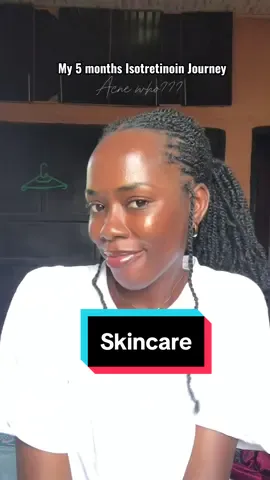 Dear black girl,  Let’s talk about how Acne stripes you of your confidence 😭😭. Let’s talk about how you will have to pass through 7000seas and 20,000 mountains to get effective skincare produces that doesn’t attempt to bleach your beautiful Black skin 😭😭😭. I’ve really come a long way man 🥰🥰🥰🎉🎉🎉 and I can help you find your way. Send a dm and lets get started 🥰😊 #skincare #acutane #skincarejourney #blackgirlskincare 
