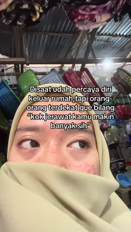 Sakit banget dengernya😭🥹🥹#jerawatan#pejuangjerawat#acnefighter#sensitif#problem#insecure#acneproneskin#semangatberjuang 