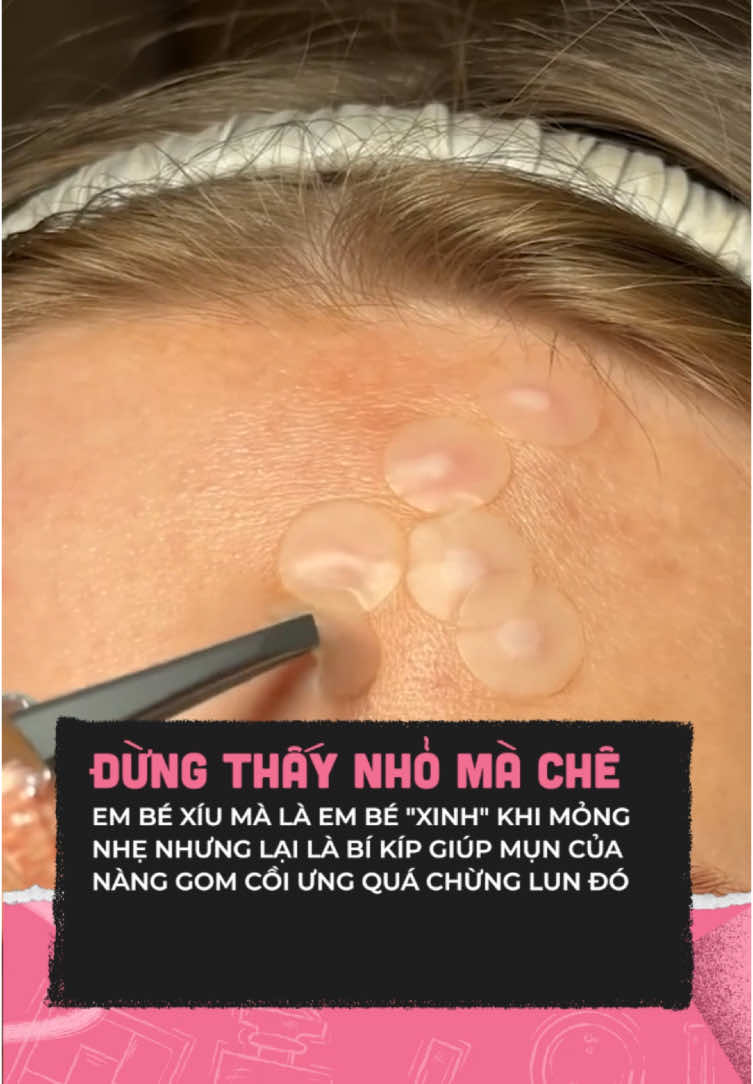 Các nàng rất mê #clmedia #celebnetwork #clbeauty #trending #hot #miengdanmun #cosrx #miengdanmuncorsx 
