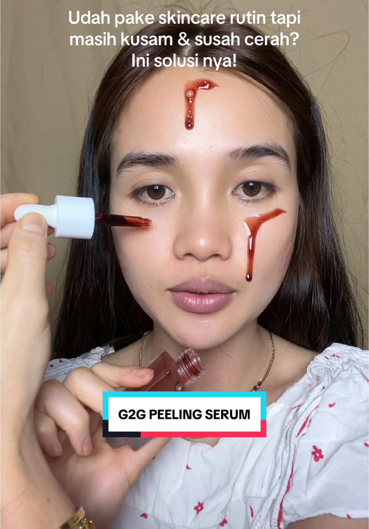 Jadi exfoliasi itu wajib & penting ya!! #glad2glowpeelingsolution #glad2gloweksfoliasi #glad2glowpeelingserum #glad2glow #peelingserum 