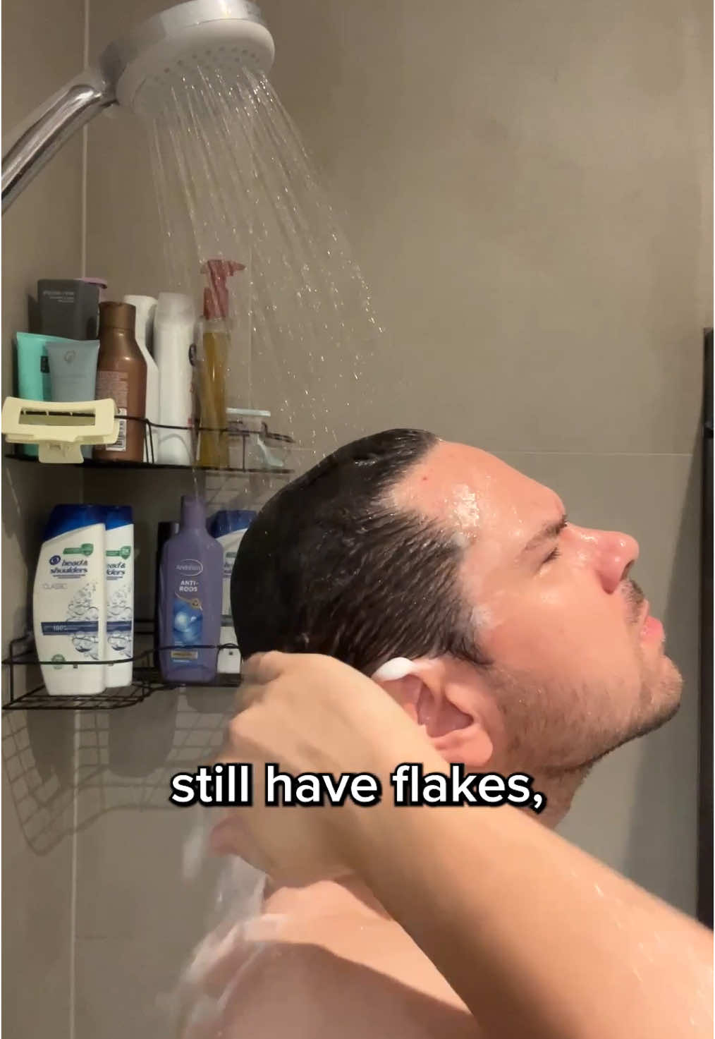 Trying every dandruff shampoo so you don’t have to episode 2: Andrélon. Come join me on a mission to save my scalp. ❄️ #dandruff #shampoo #itchyscalp #sebderm #scalpcare #druffboy