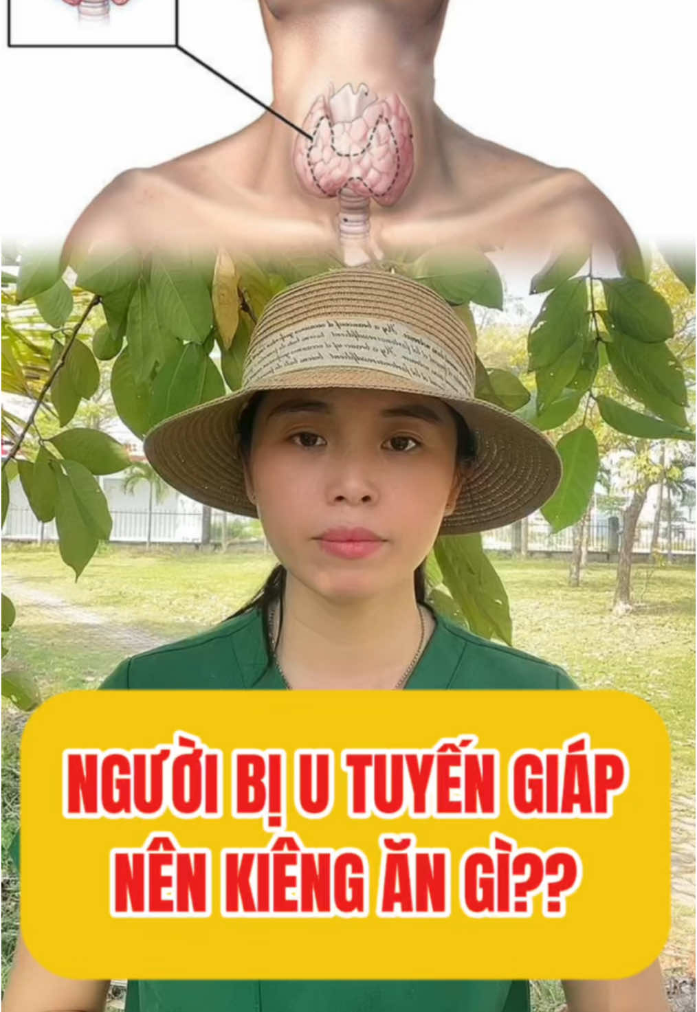 Người bị u tuyến giáp nên kiêng ăn gì? #utuyengiap #ungthu #suckhoe #thanhvodongy #cuonggiap #buouco