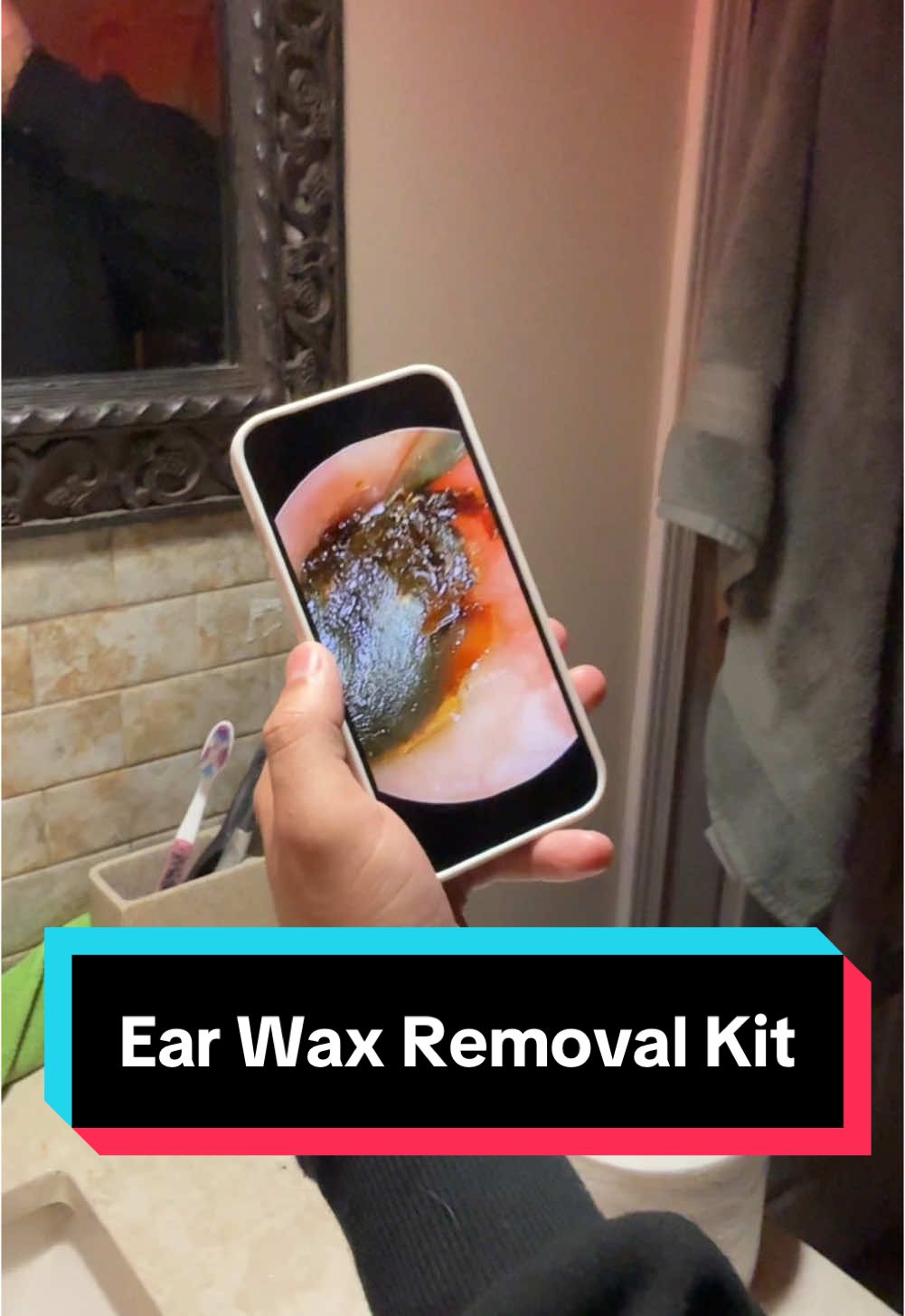 He has so much earwax in his ear 😭 #tiktokshopblackfriday #tiktokshopcybermonday #earwax #earwaxremoval #earwaxremmoval #giftidea #spotlightfinds 