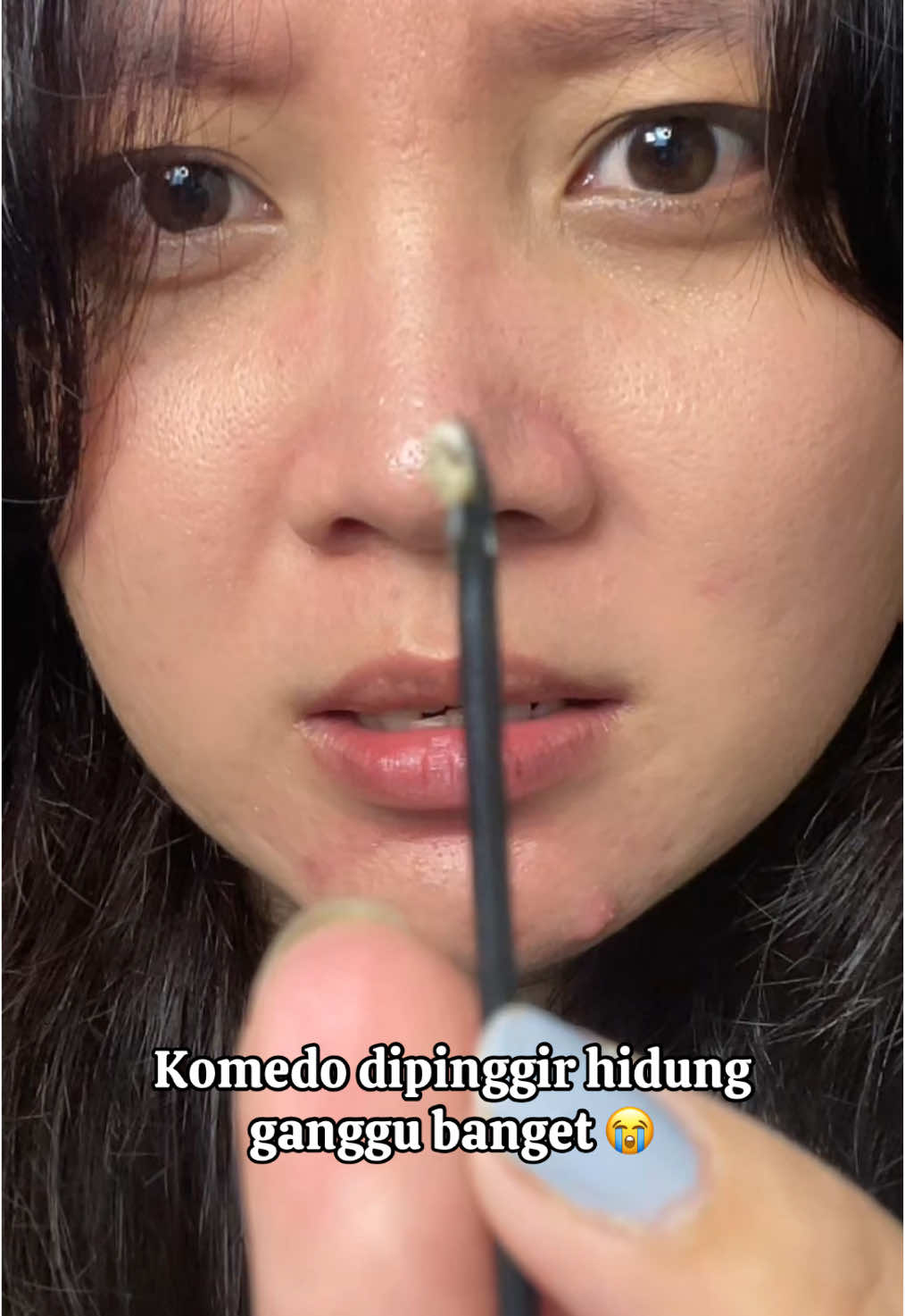 Sumpahh komedo dipinggir hidung tuh ganggu bangettt!! Mana susah banget diambilnya. Untung aku pakai Blackhead remover nose patch dari @FOCALSKIN Indonesia 🥹💖  #focalskin #blackheadsremoval #komedo #focalskinid #nosepatch #komedohidung #whiteheadsremoval #fyp 